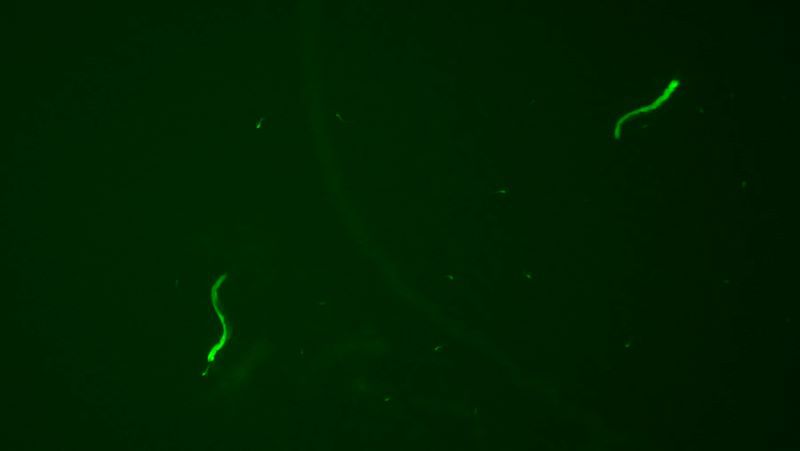 绿色荧光蛋白（GFP）在C elegans上的表达